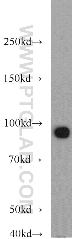 Glucocorticoid receptor Polyclonal antibody