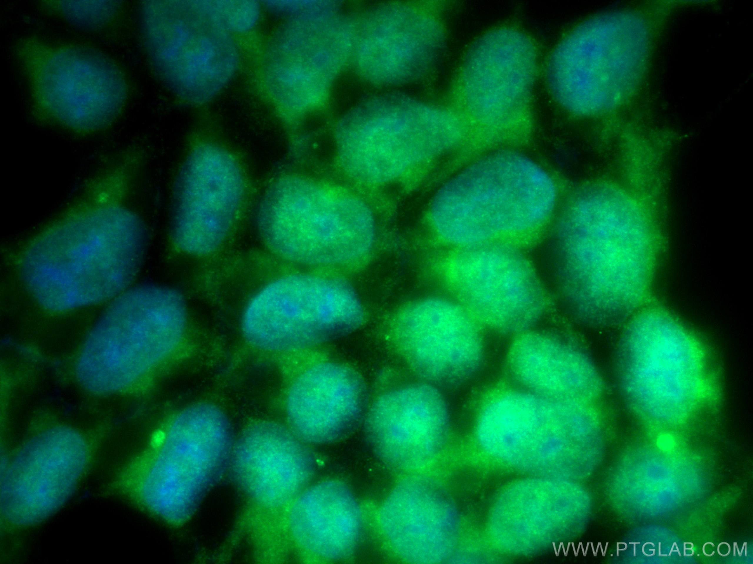Immunofluorescence (IF) / fluorescent staining of HEK-293 cells using NR3C2 Polyclonal antibody (21854-1-AP)