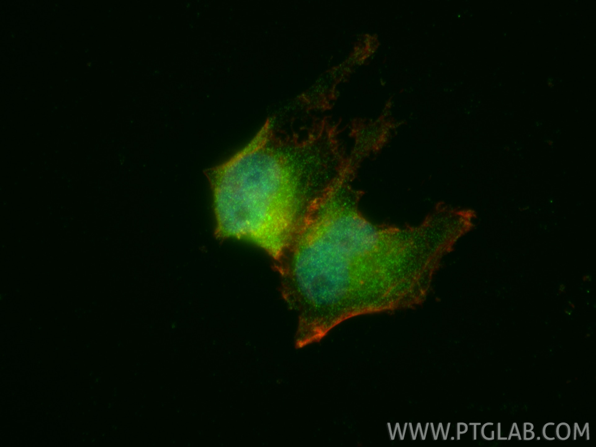 IF Staining of HEK-293 using 21854-1-AP Immunofluorescence (IF) / fluorescent staining of HEK-293 cells using NR3C2 Polyclonal antibody (21854-1-AP)