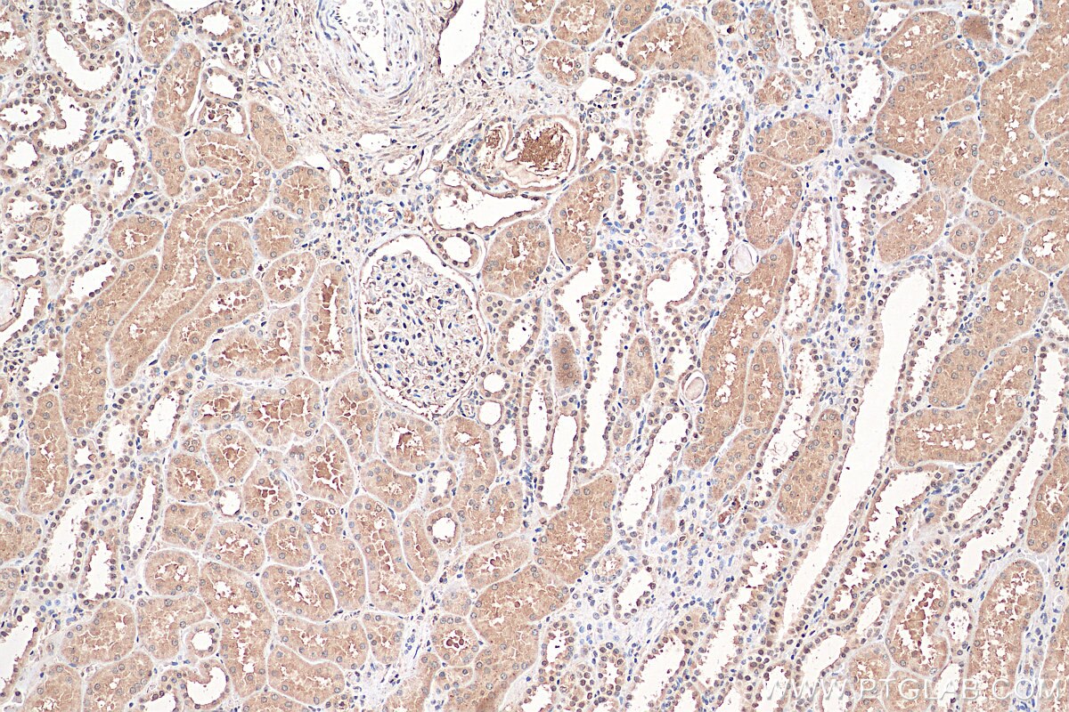 Immunohistochemistry (IHC) staining of human kidney tissue using NR3C2 Polyclonal antibody (21854-1-AP)