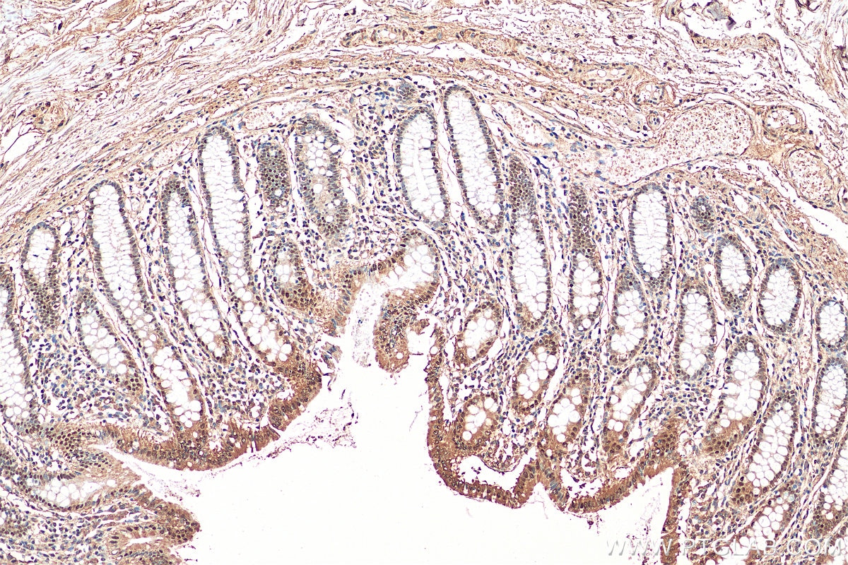 Immunohistochemistry (IHC) staining of human colon tissue using NR3C2 Polyclonal antibody (21854-1-AP)