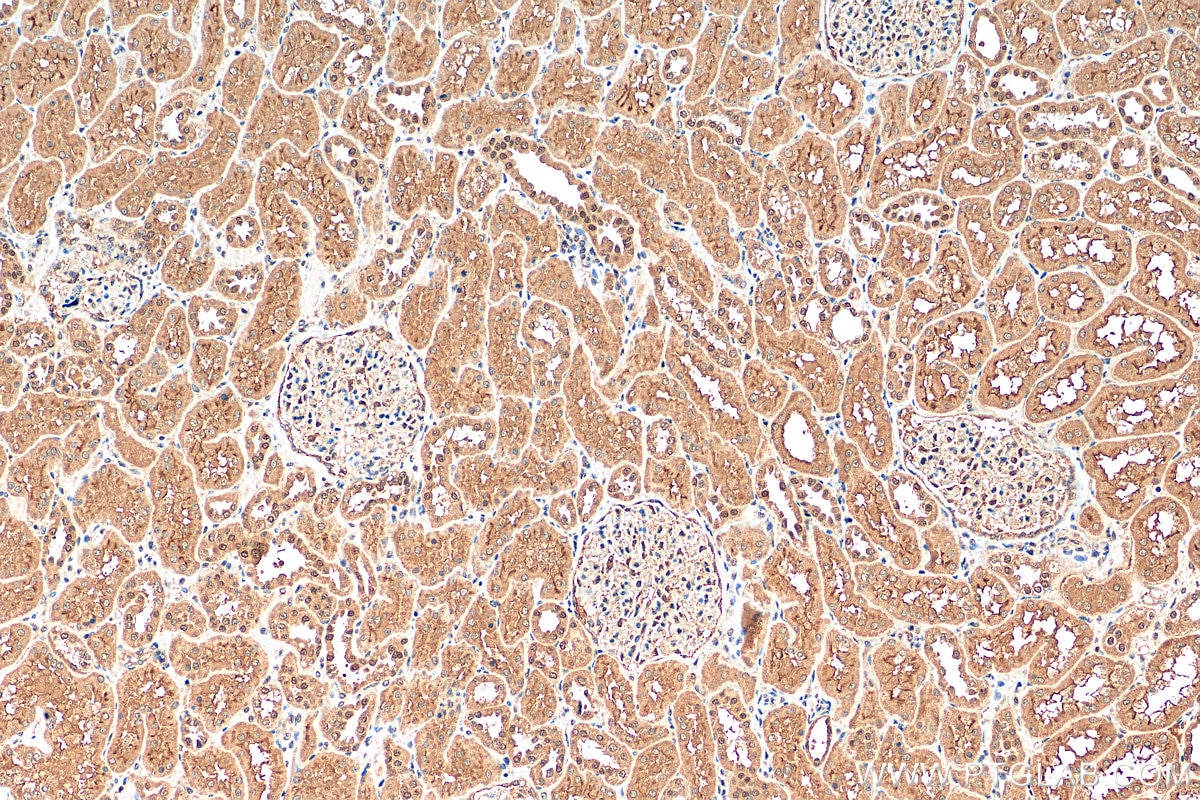 Immunohistochemistry (IHC) staining of human kidney tissue using NR3C2 Polyclonal antibody (21854-1-AP)