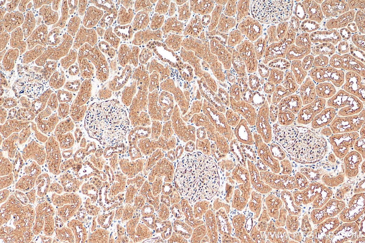 IHC staining of human kidney using 21854-1-AP