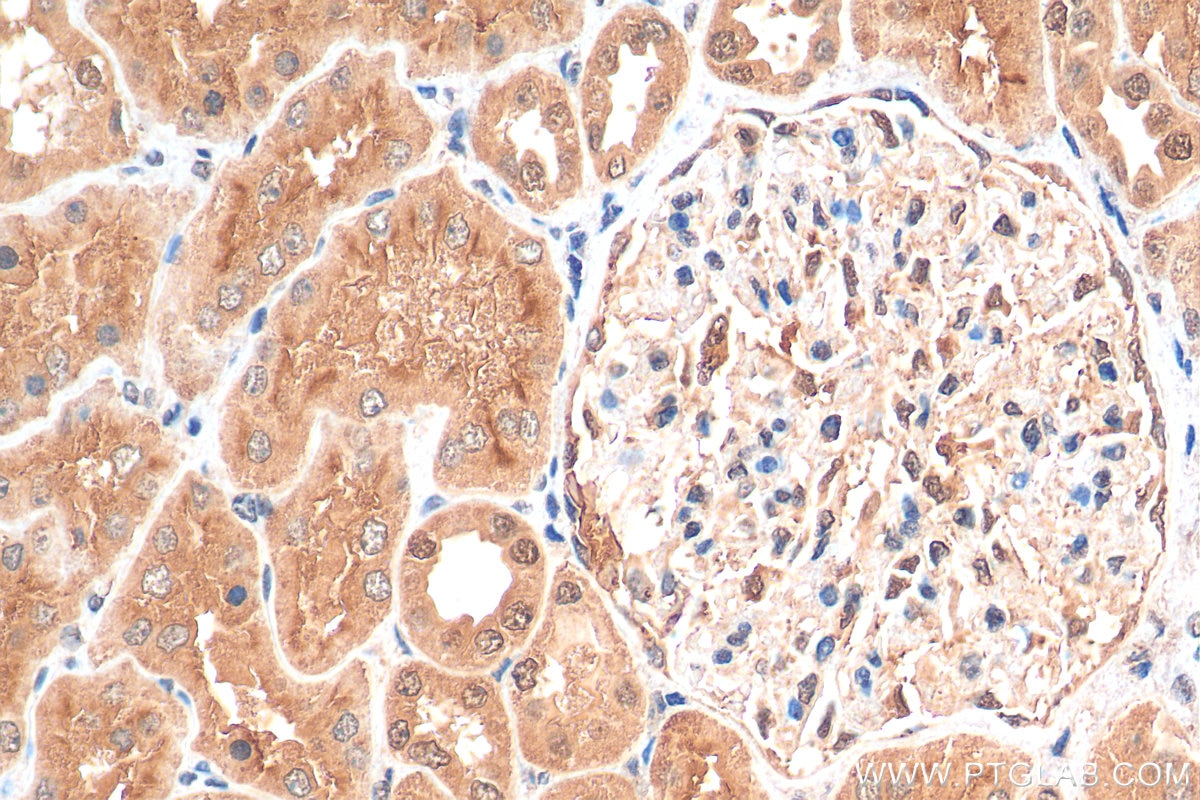 Immunohistochemistry (IHC) staining of human kidney tissue using NR3C2 Polyclonal antibody (21854-1-AP)