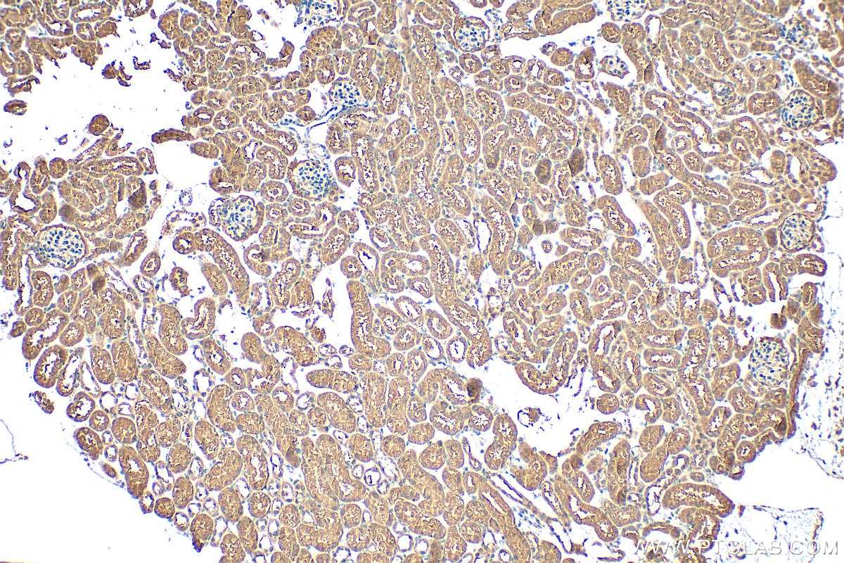 Immunohistochemistry (IHC) staining of mouse kidney tissue using NR3C2 Polyclonal antibody (21854-1-AP)