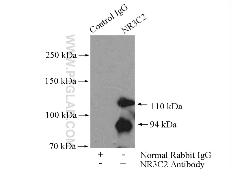 Immunoprecipitation (IP) experiment of HEK-293 cells using NR3C2 Polyclonal antibody (21854-1-AP)