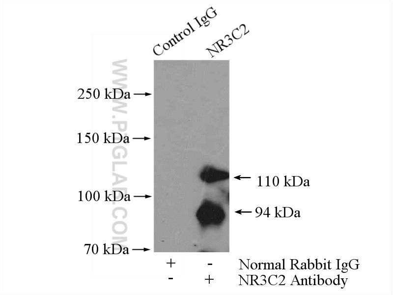 IP experiment of HEK-293 using 21854-1-AP