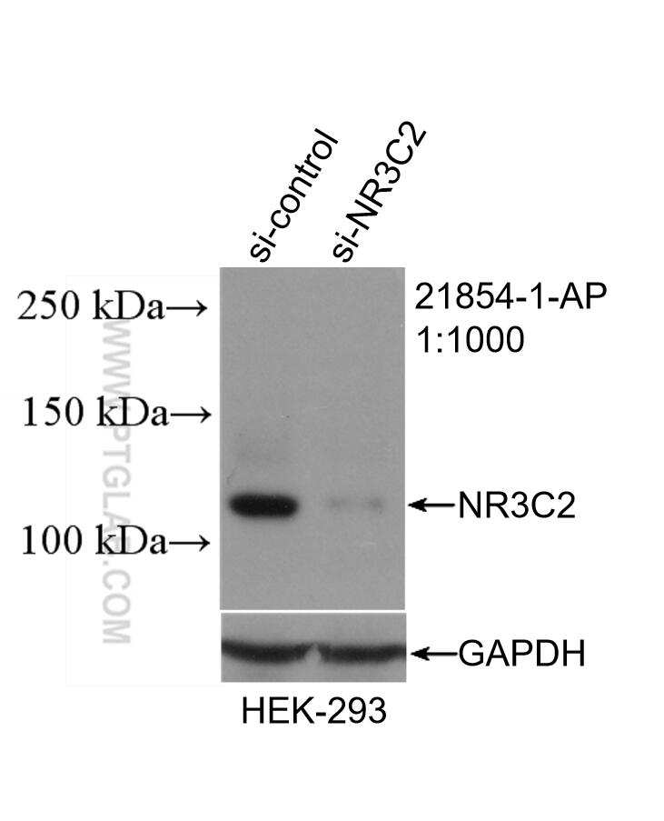 Western Blot (WB) analysis of HEK-293 cells using NR3C2 Polyclonal antibody (21854-1-AP)