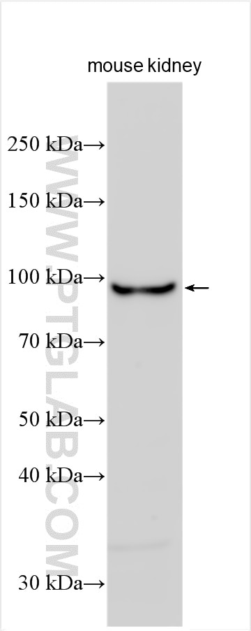 Western Blot (WB) analysis of mouse kidney tissue using NR3C2 Polyclonal antibody (21854-1-AP)