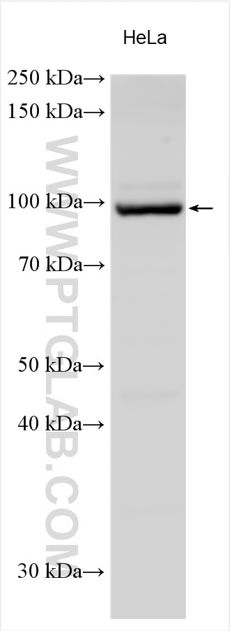 Western Blot (WB) analysis of various lysates using NR3C2 Polyclonal antibody (21854-1-AP)