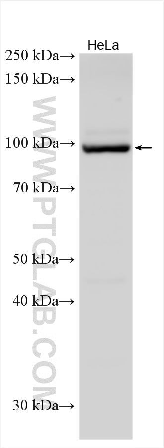 Western Blot (WB) analysis of various lysates using NR3C2 Polyclonal antibody (21854-1-AP)