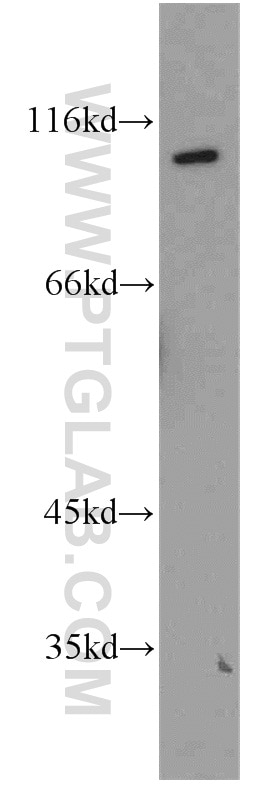 NR3C2 Polyclonal antibody