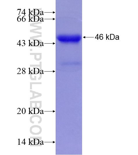 NR3C2 fusion protein Ag28939 SDS-PAGE