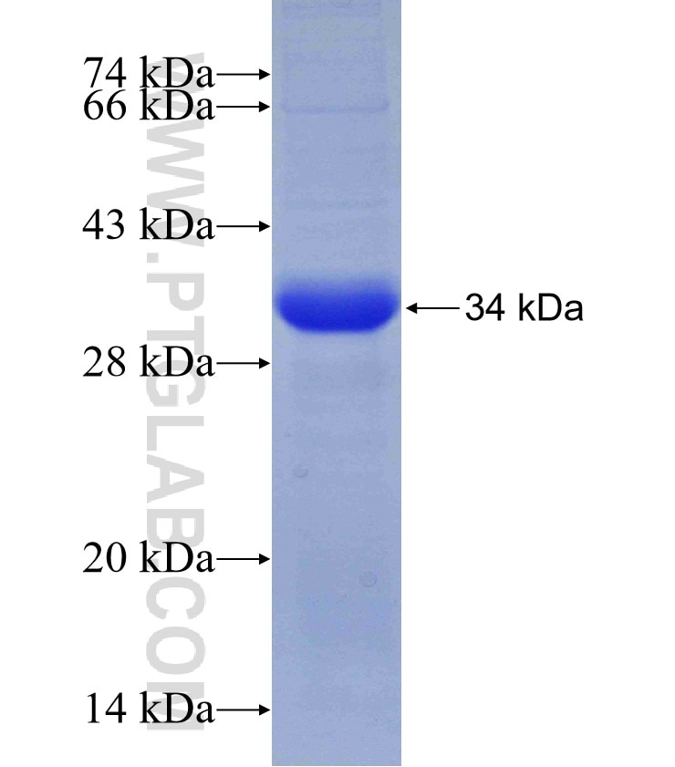NR3C2 fusion protein Ag29436 SDS-PAGE