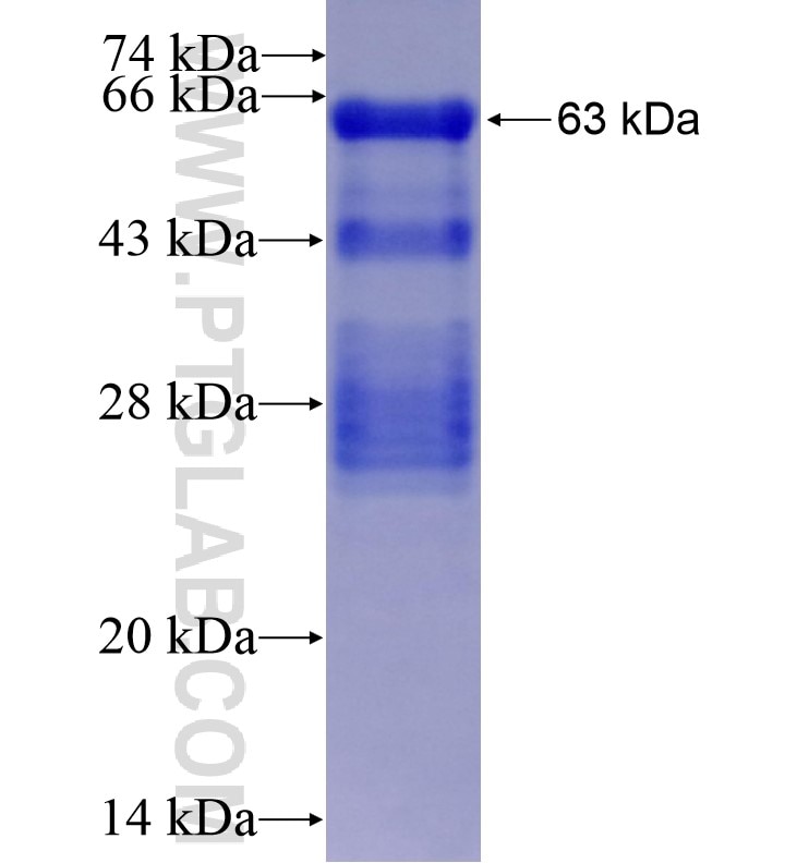 NR3C2 fusion protein Ag16410 SDS-PAGE