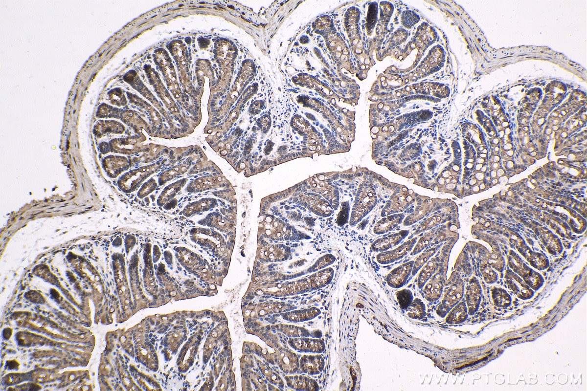 IHC staining of mouse colon using 12235-1-AP