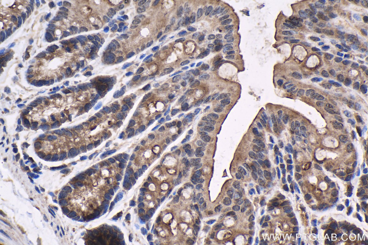 Immunohistochemistry (IHC) staining of mouse colon tissue using NR4A1 Polyclonal antibody (12235-1-AP)