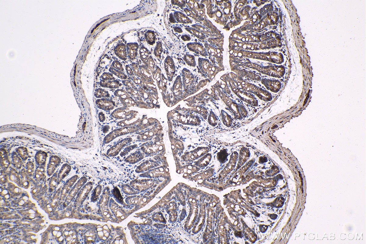 Immunohistochemistry (IHC) staining of mouse colon tissue using NR4A1 Polyclonal antibody (25851-1-AP)