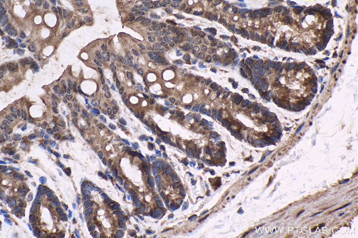 Immunohistochemistry (IHC) staining of mouse colon tissue using NR4A1 Polyclonal antibody (25851-1-AP)