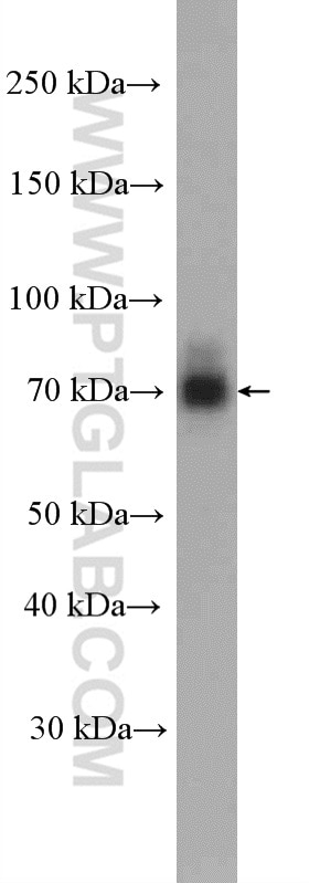 WB analysis of PC-3 using 25851-1-AP