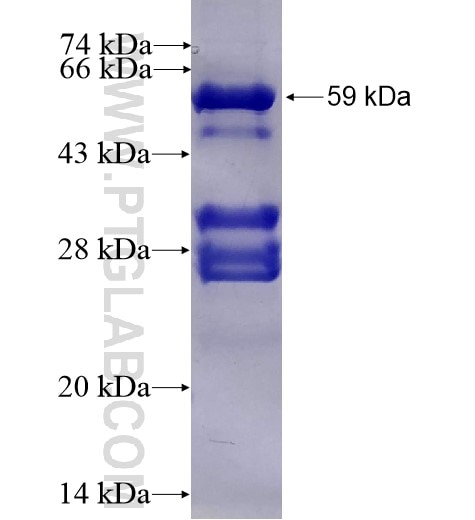 NR4A1 fusion protein Ag2875 SDS-PAGE