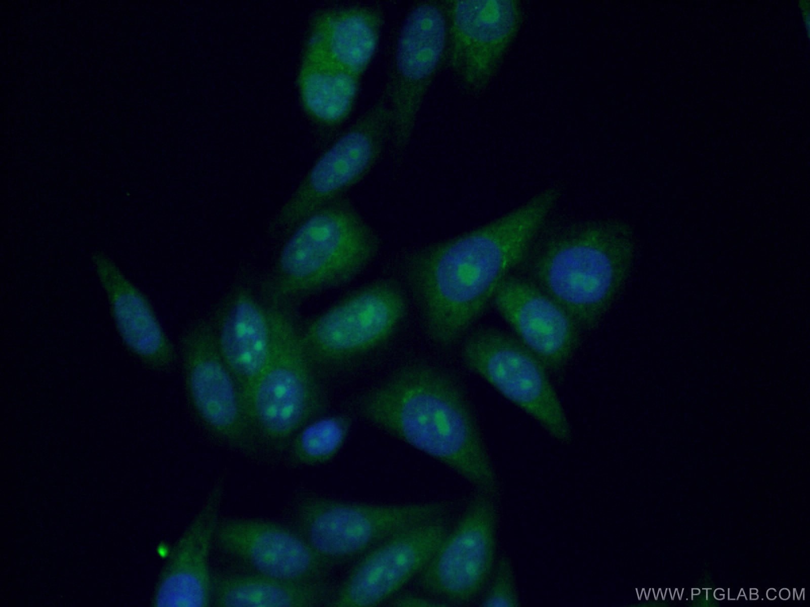 Immunofluorescence (IF) / fluorescent staining of HepG2 cells using Nurr1/NR4A2 Polyclonal antibody (10975-2-AP)