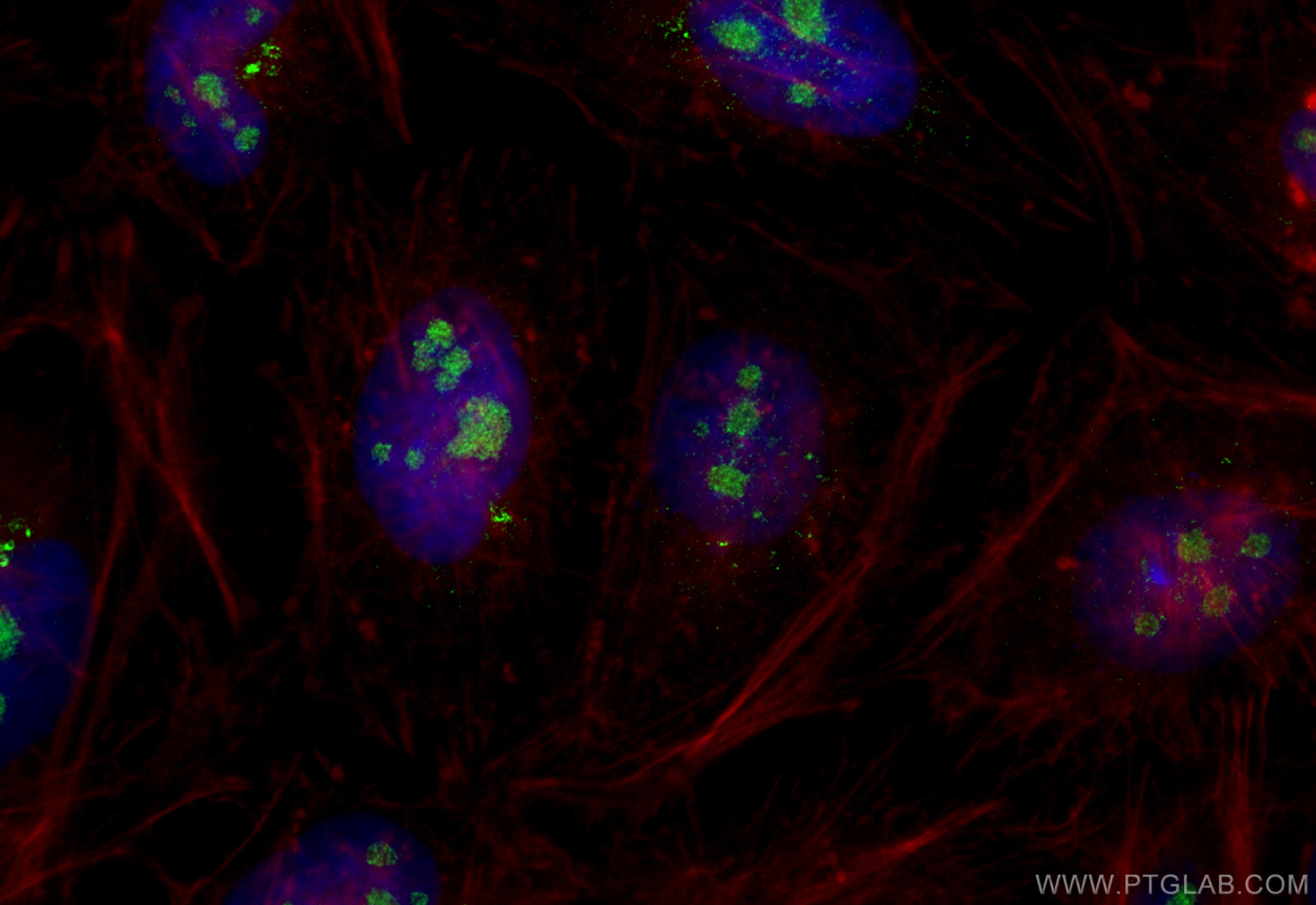 Immunofluorescence (IF) / fluorescent staining of HeLa cells using Nurr1/NR4A2 Polyclonal antibody (10975-2-AP)