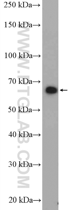 Western Blot (WB) analysis of fetal human brain tissue using Nurr1/NR4A2 Polyclonal antibody (10975-2-AP)