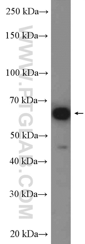 WB analysis of SH-SY5Y using 10975-2-AP