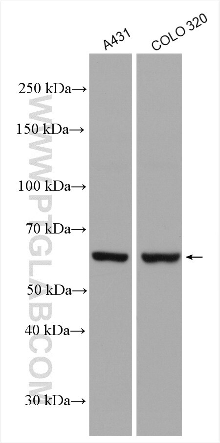 Western Blot (WB) analysis of various lysates using Nurr1/NR4A2 Polyclonal antibody (10975-2-AP)