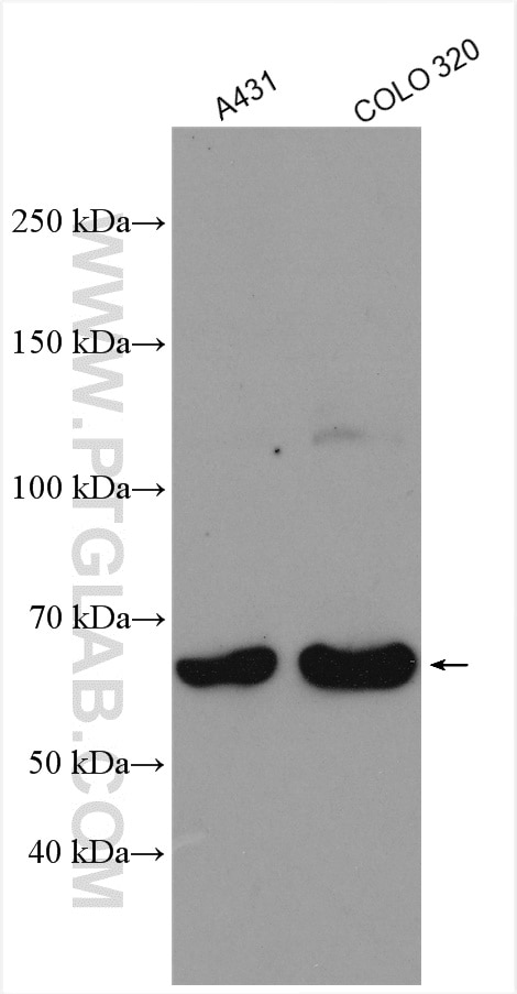 Western Blot (WB) analysis of various lysates using Nurr1/NR4A2 Polyclonal antibody (10975-2-AP)