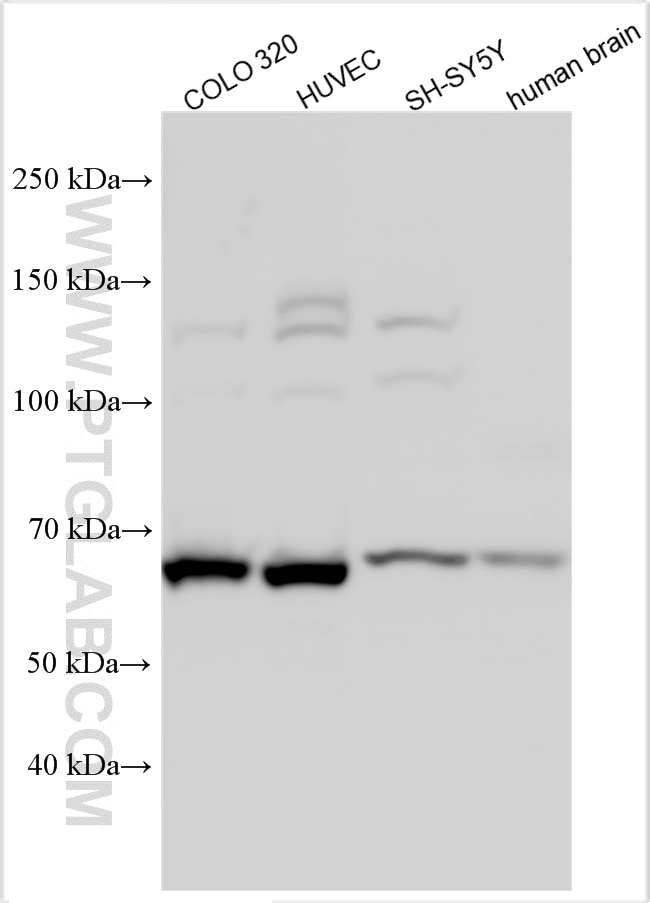 Western Blot (WB) analysis of various lysates using Nurr1/NR4A2 Polyclonal antibody (10975-2-AP)
