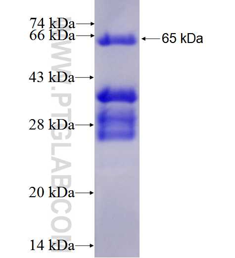 NR4A2 fusion protein Ag1418 SDS-PAGE