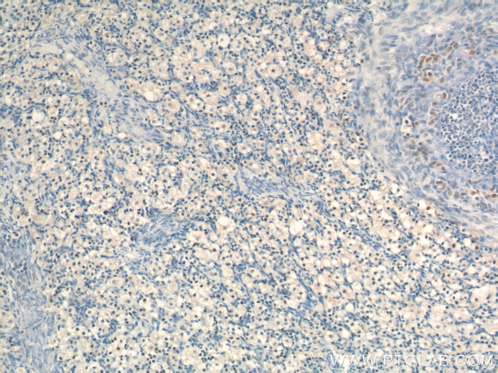 Immunohistochemistry (IHC) staining of human ovary tissue using NR5A1 Polyclonal antibody (18658-1-AP)