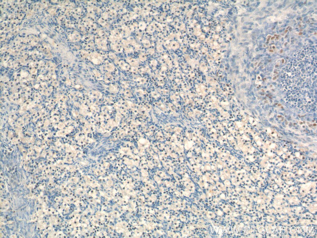 IHC staining of human ovary using 18658-1-AP