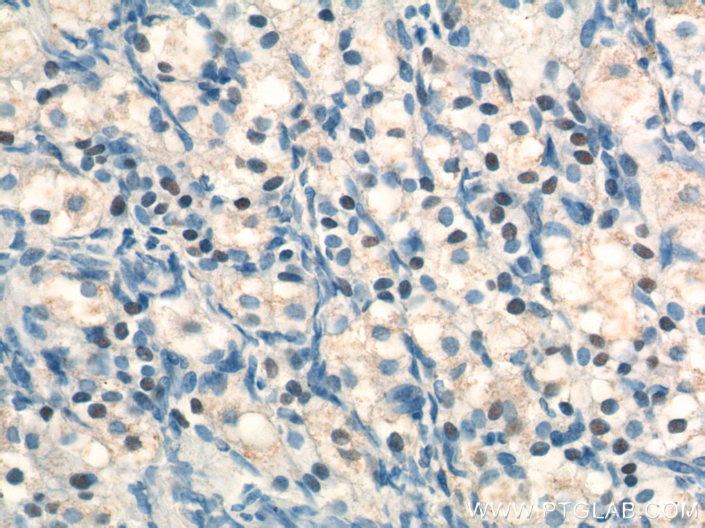 Immunohistochemistry (IHC) staining of human ovary tissue using NR5A1 Polyclonal antibody (18658-1-AP)
