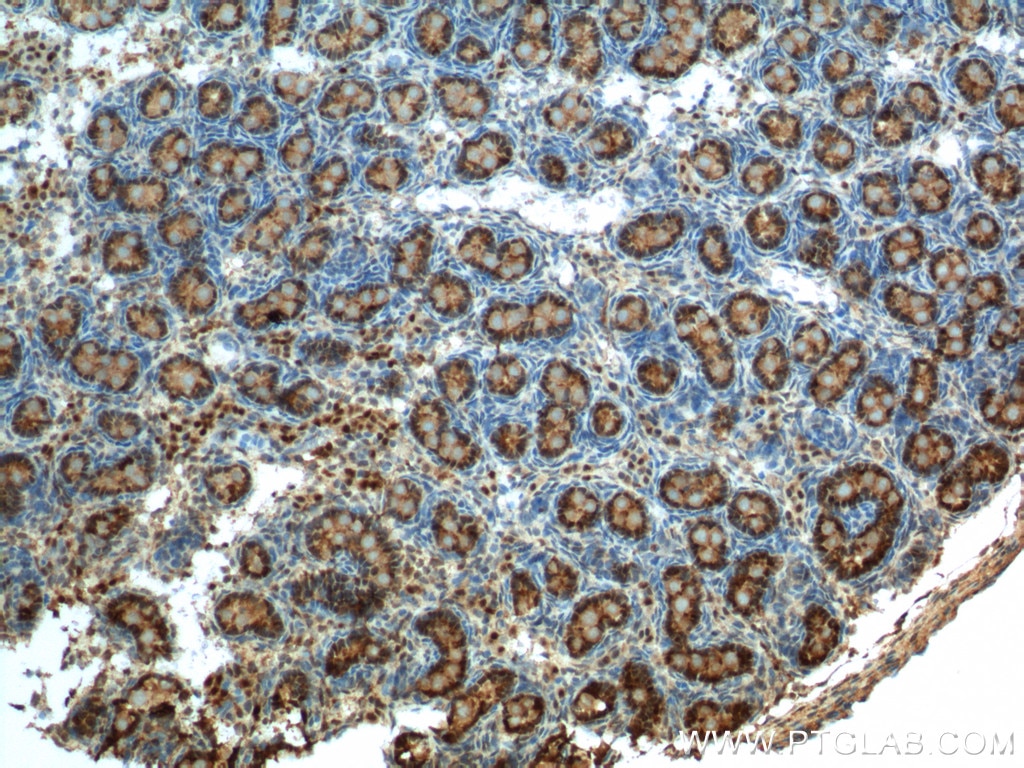 Immunohistochemistry (IHC) staining of rat testis tissue using NR5A1 Polyclonal antibody (18658-1-AP)