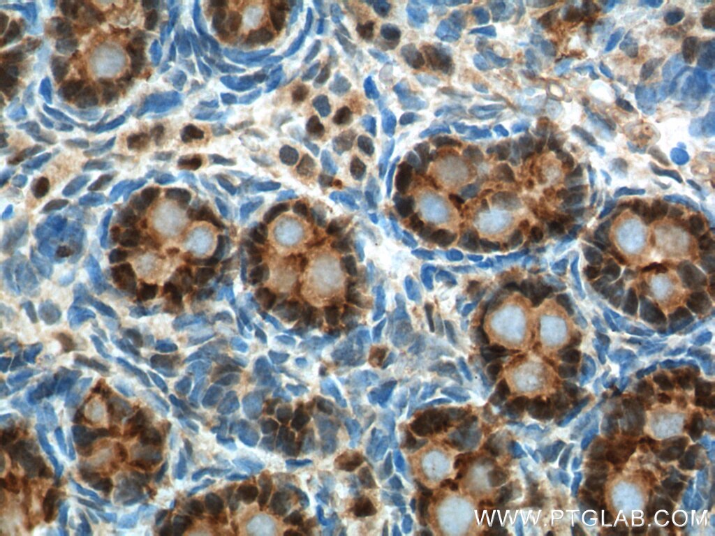 Immunohistochemistry (IHC) staining of rat testis tissue using NR5A1 Polyclonal antibody (18658-1-AP)