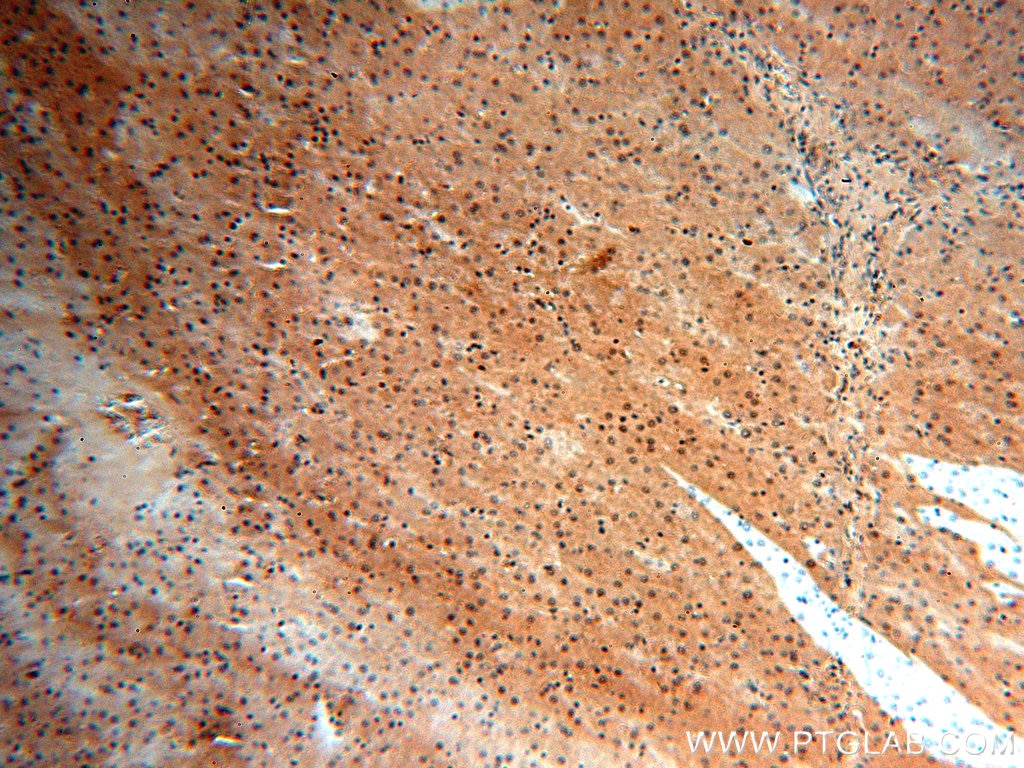 Immunohistochemistry (IHC) staining of human liver tissue using NR5A1 Polyclonal antibody (18658-1-AP)