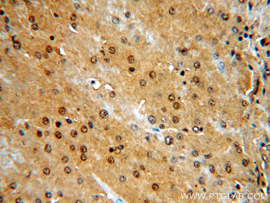 Immunohistochemistry (IHC) staining of human liver tissue using NR5A1 Polyclonal antibody (18658-1-AP)