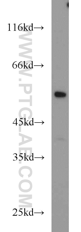 NR5A1 Polyclonal antibody