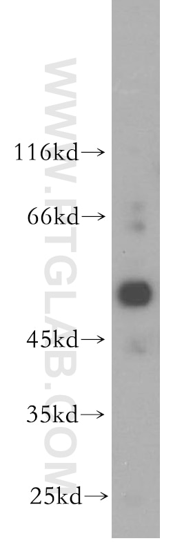 Western Blot (WB) analysis of mouse ovary tissue using NR5A1 Polyclonal antibody (18658-1-AP)