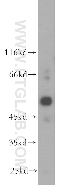 WB analysis of mouse ovary using 18658-1-AP