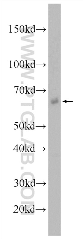 Western Blot (WB) analysis of rat testis tissue using NR5A2 Polyclonal antibody (22460-1-AP)