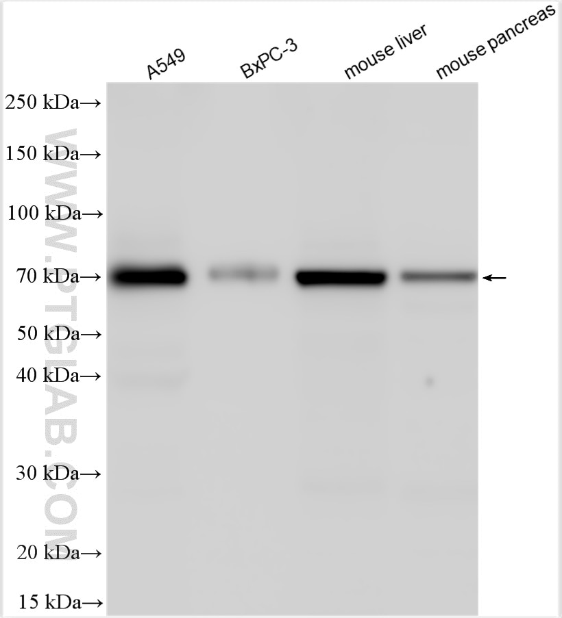 Western Blot (WB) analysis of various lysates using NR5A2 Polyclonal antibody (22460-1-AP)
