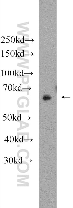 Western Blot (WB) analysis of mouse ovary tissue using NR5A2 Polyclonal antibody (22460-1-AP)