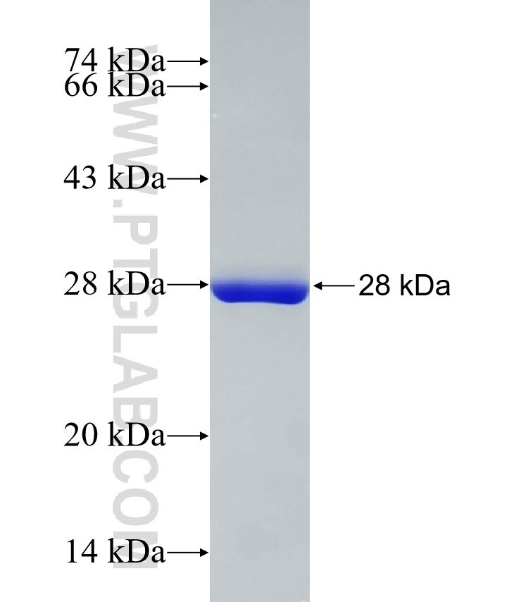 NR5A2 fusion protein Ag19323 SDS-PAGE