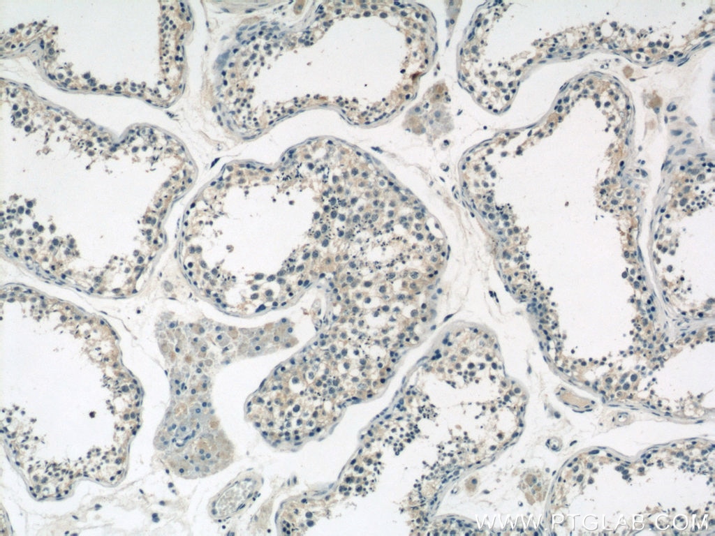 Immunohistochemistry (IHC) staining of human testis tissue using GCNF Polyclonal antibody (12712-1-AP)