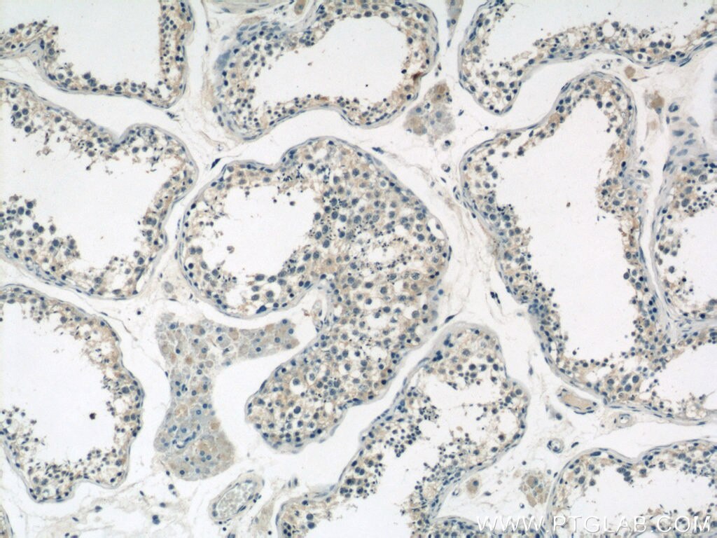 IHC staining of human testis using 12712-1-AP