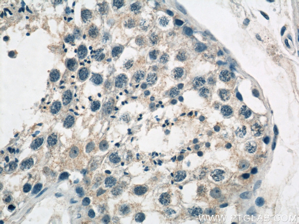 Immunohistochemistry (IHC) staining of human testis tissue using GCNF Polyclonal antibody (12712-1-AP)